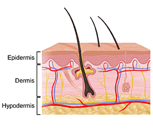 Cross section of skin showing dermis, epidermis, and hypodermis.