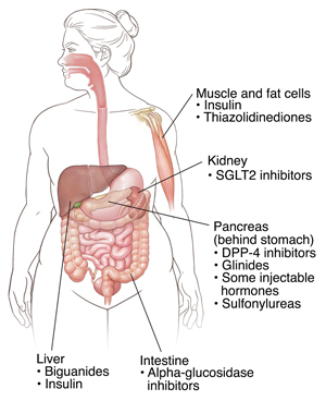 Outline of human figure showing locations where diabetes medicatinos work.