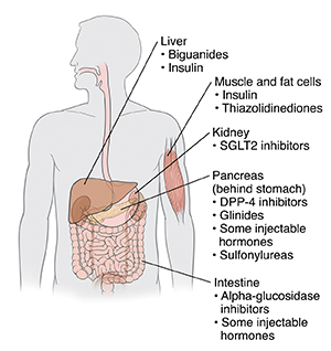 Outline of human figure showing locations where diabetes medicatinos work.