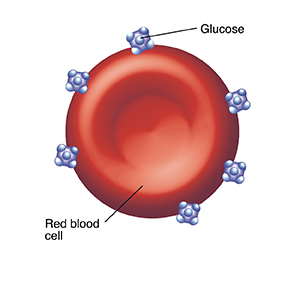 Red blood cell with glucose molecules stuck to it.